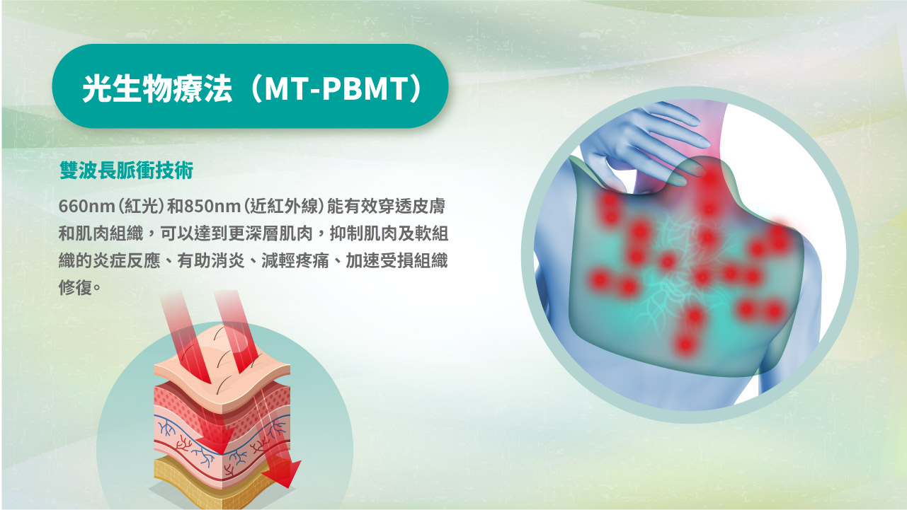 紅光光療披肩 光生物療法 (MT-PBMT)
